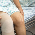 Full Knee Replacement