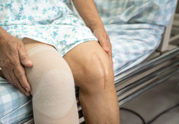 Full Knee Replacement